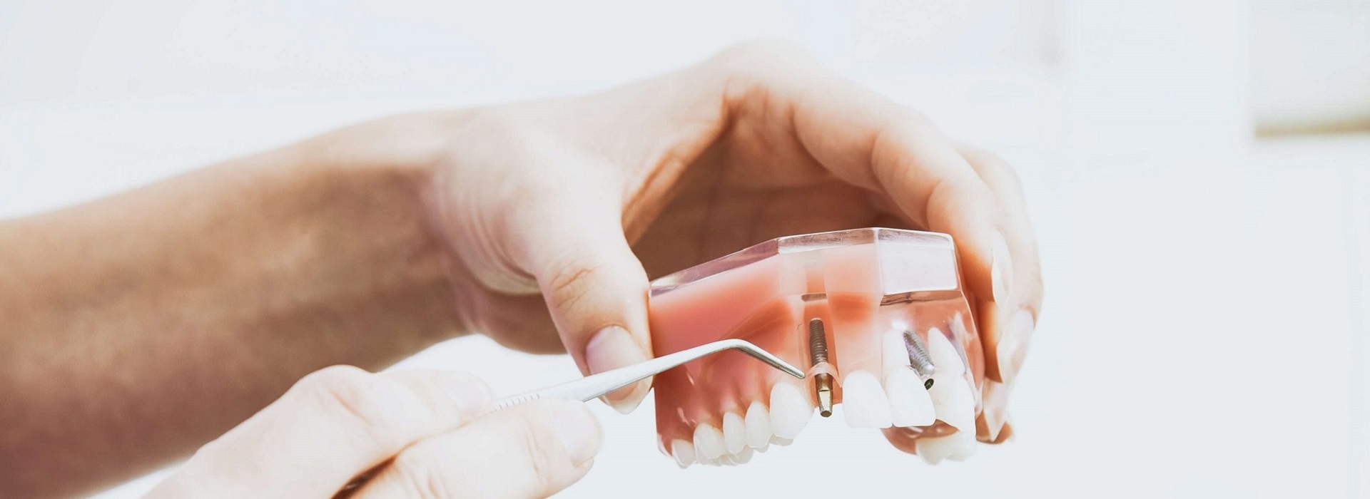 Cryogas | Dental implants Belgrade